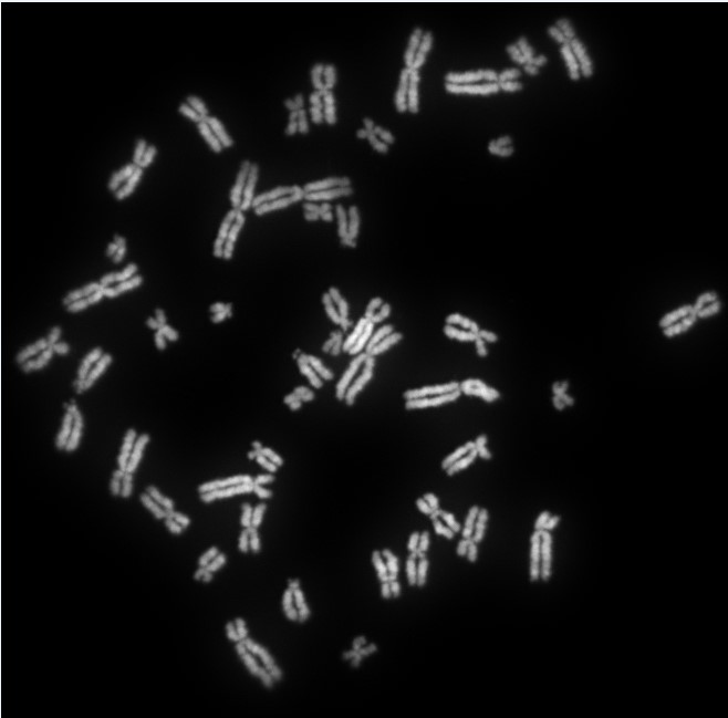 A black and white image of a set of human female chromosomes scattered against a black background